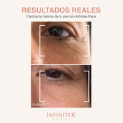 Multi-Active 360 Contorno de Ojos