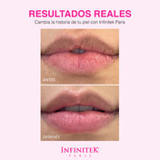 Luxury Lip Balm