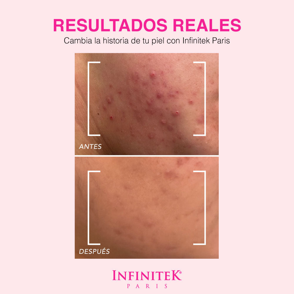 Mascarilla de Barro del Mar Muerto