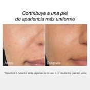 Kit Luminosidad