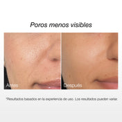 Serum Niacinamida 10% + Ácido Tranexámico 5%