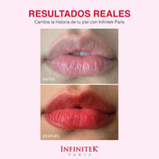 Infinit-Ink Tinta Roja