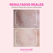 Aceite Rosa Mosqueta