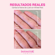 resultados reales de la crema Blossom Hand Cream 
