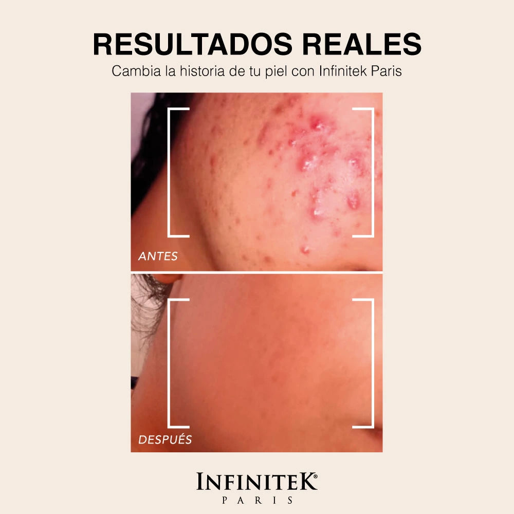 Crema Humectante Retinol