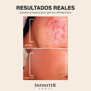 Crema Humectante Retinol