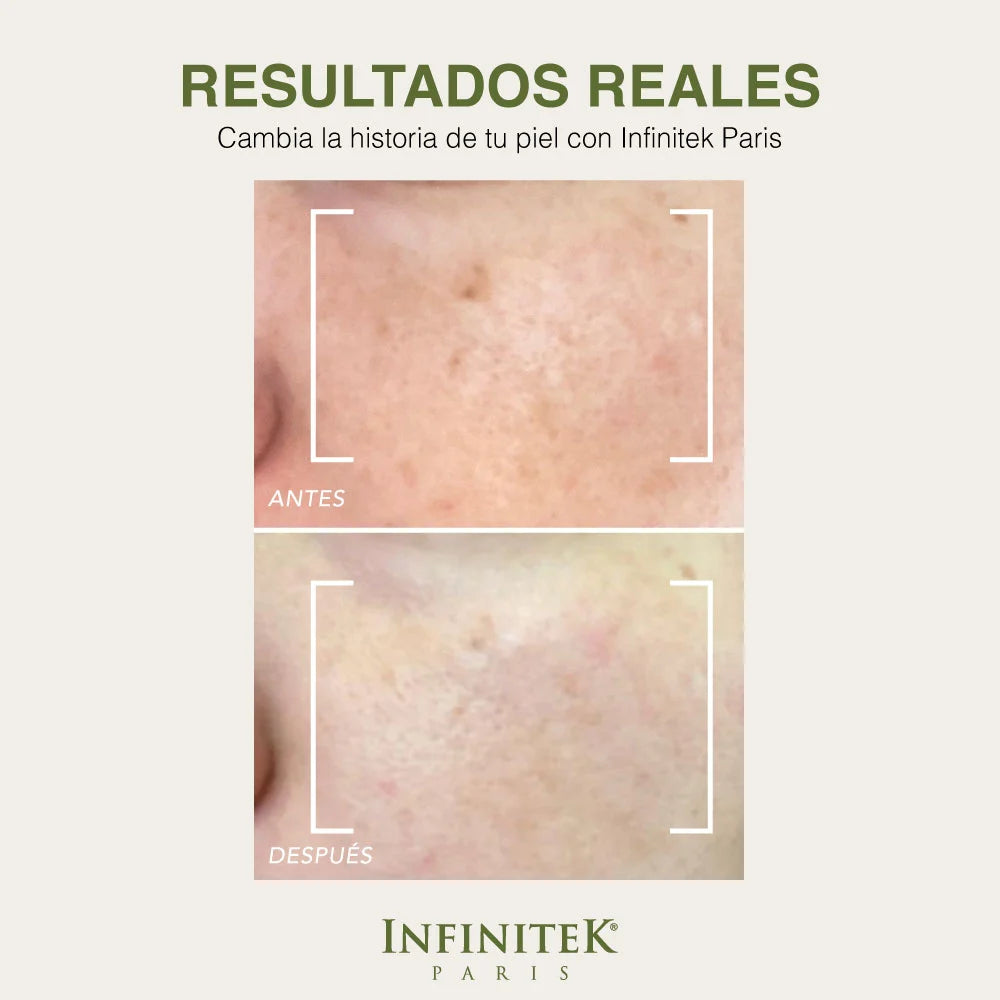 resultados reales de la Mascarilla Green Glow Mask