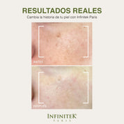 resultados reales de la Mascarilla Green Glow Mask
