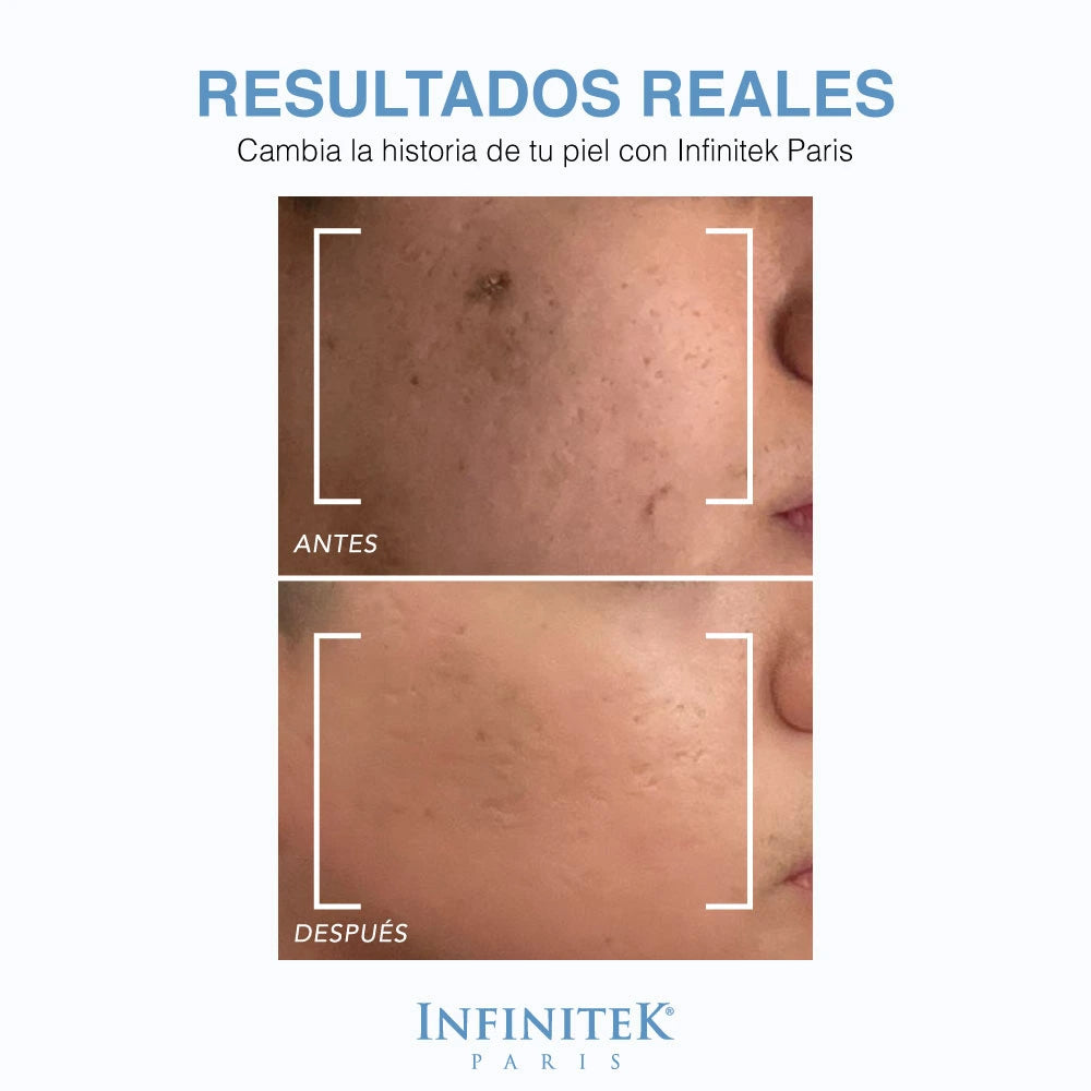 Sérum Ácido Hialurónico + Silicio Orgánico