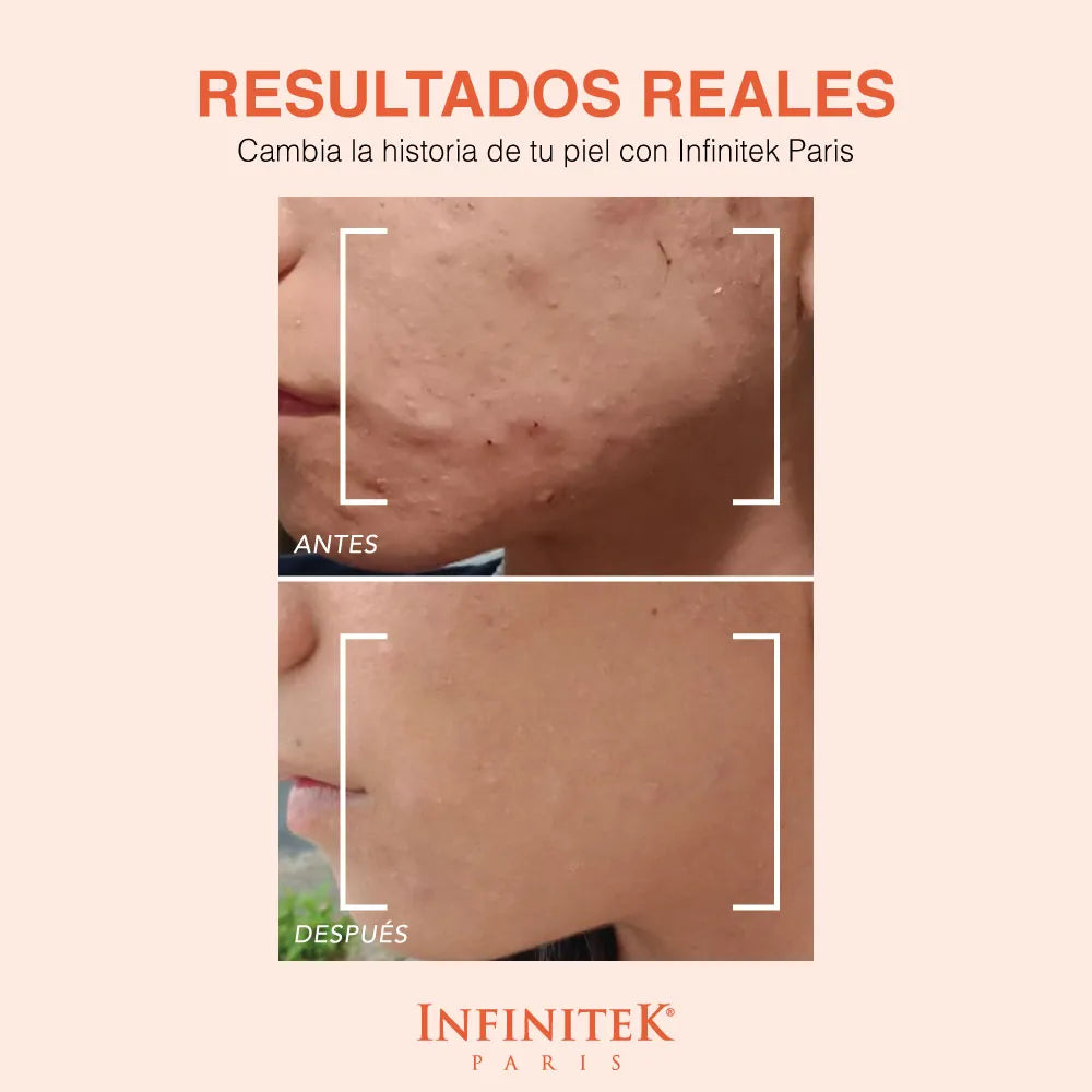 Sérum Vitamina C + Silicio Orgánico