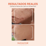 Sérum Vitamina C + Silicio Orgánico