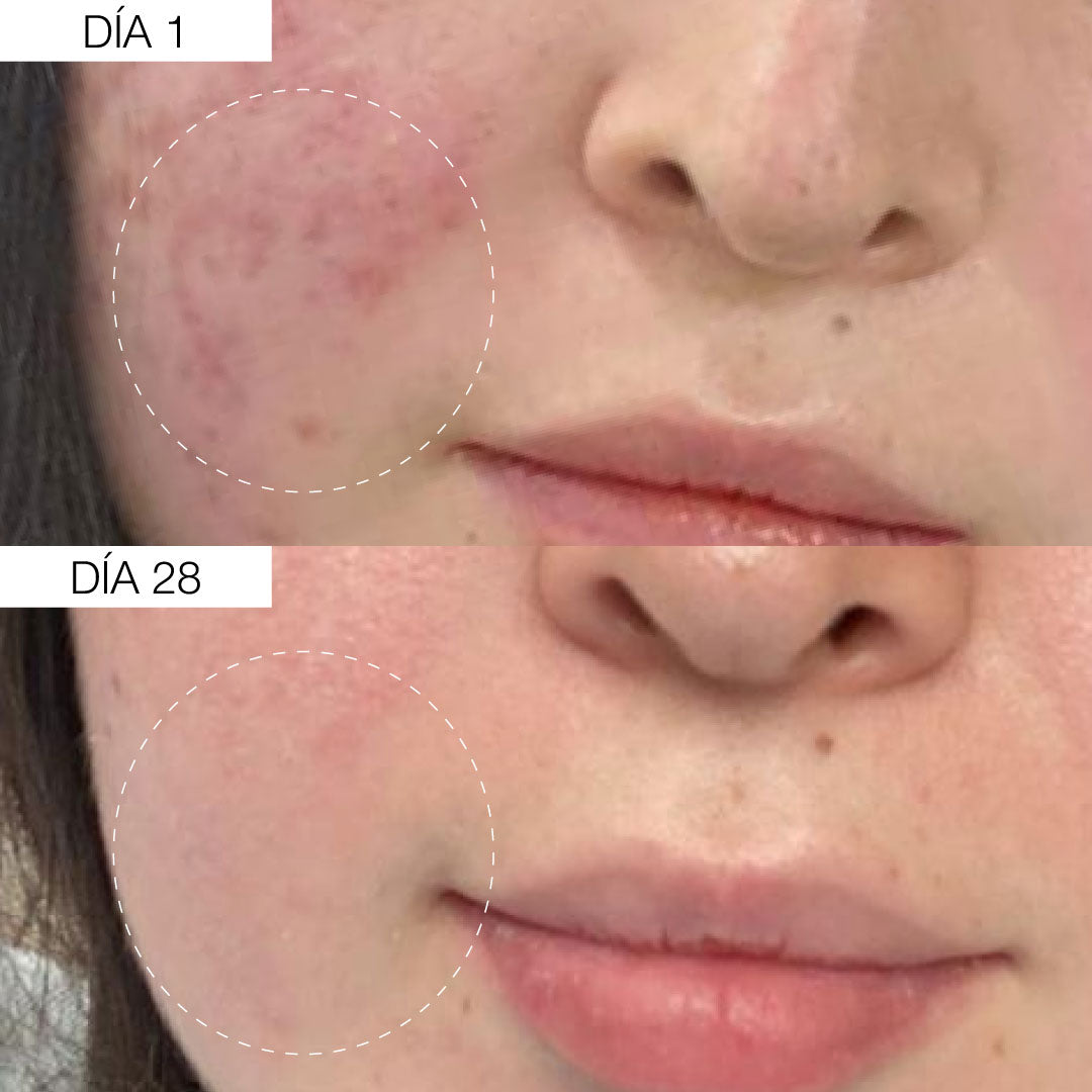 Sérum Ácido Hialurónico