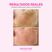 resultados reales que cambian la historia de tu piel con Serum Clarificante Crystal Rose