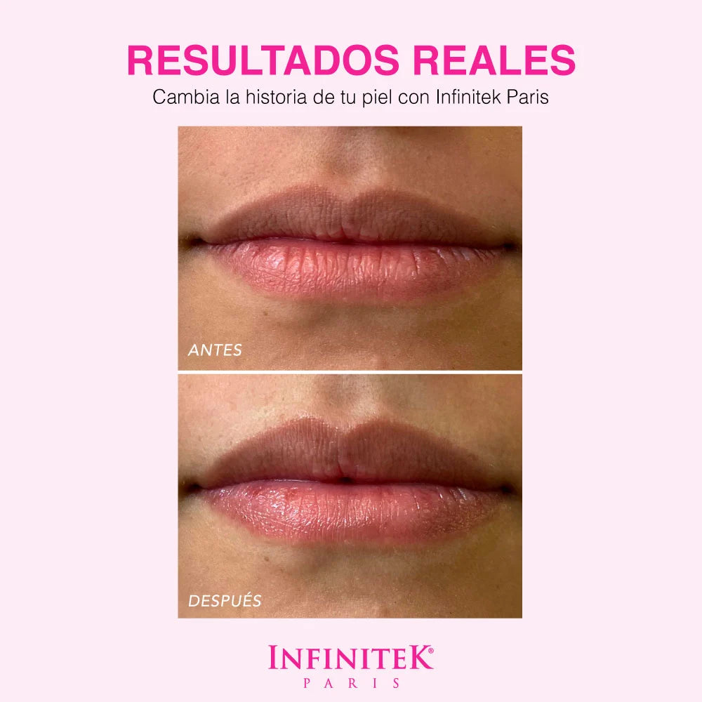 Sugar Kiss resultados reales antes y despues