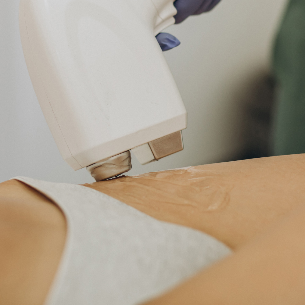 bikini de mujer aplicandose tratamiento de gel con laser