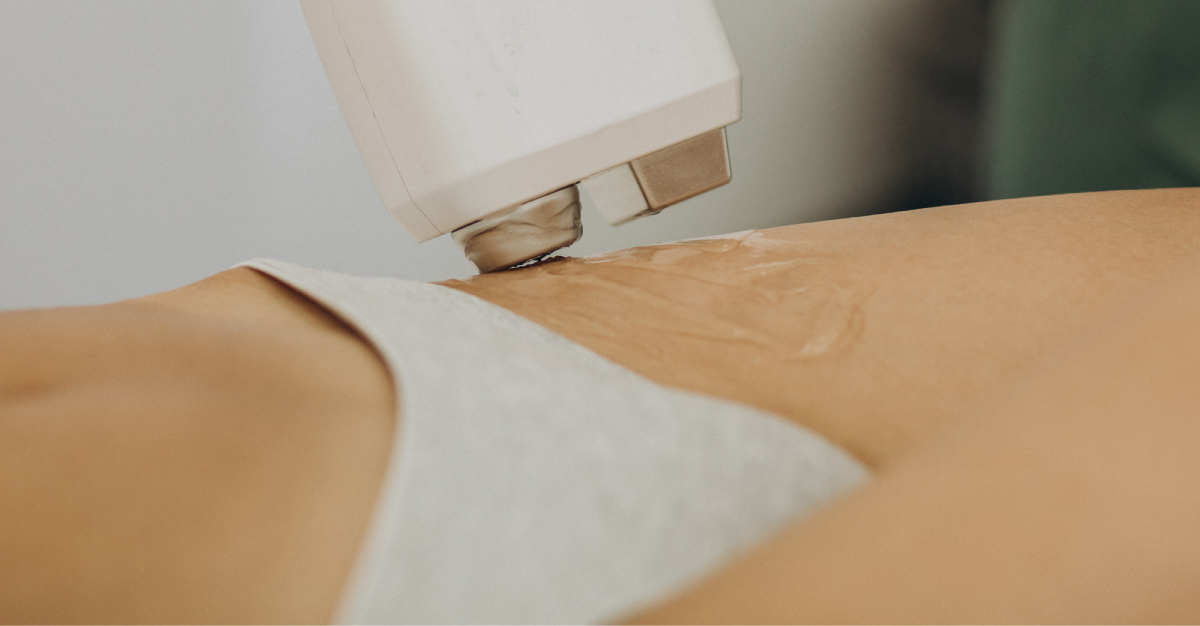 bikini de mujer aplicandose tratamiento de gel con laser