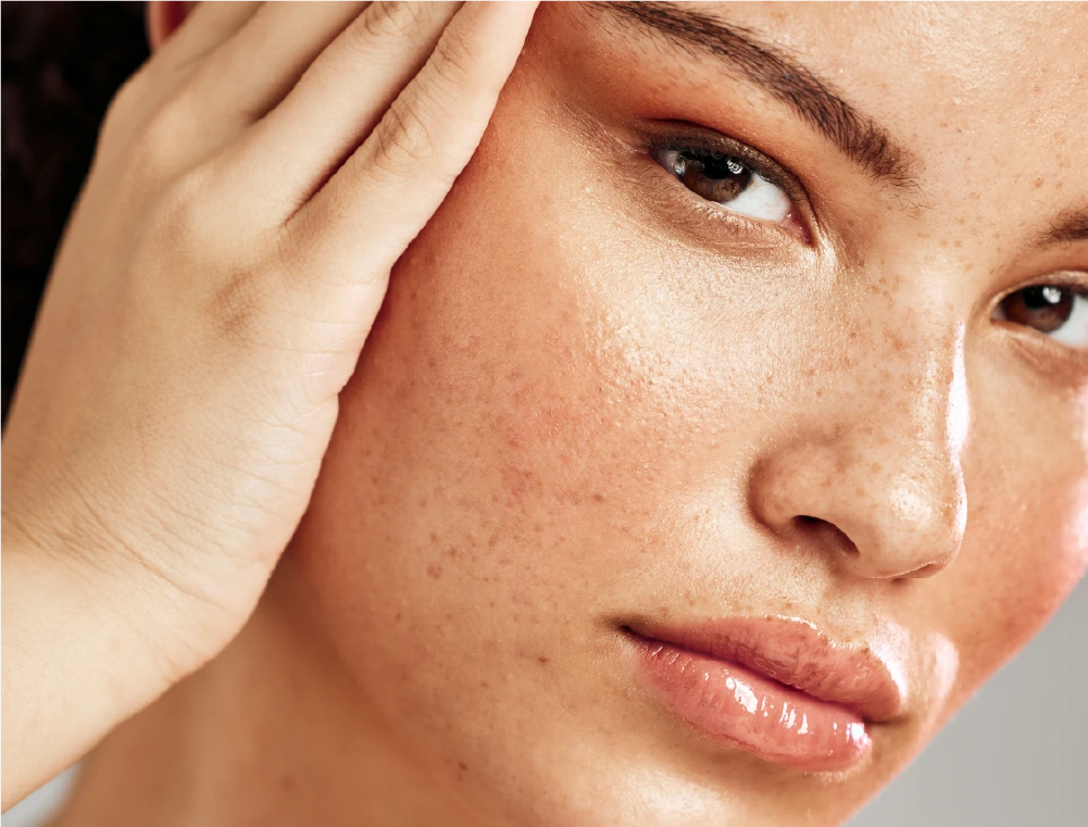 Hidratante-serum-rutina-skincare-piel-radiante